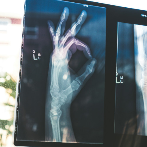 An X-ray of a hand making the 'OK' gesture.